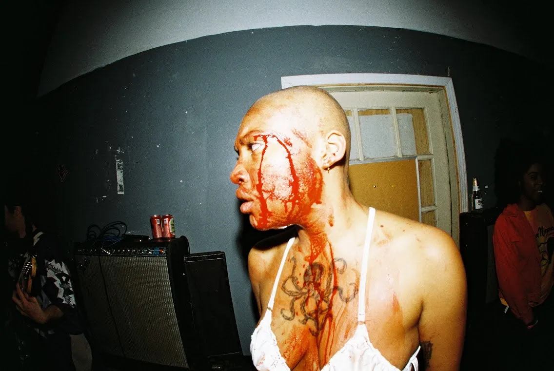 Upchuck –  Bite The Hand That Feeds (BLOOD RED VINYL) – New LP